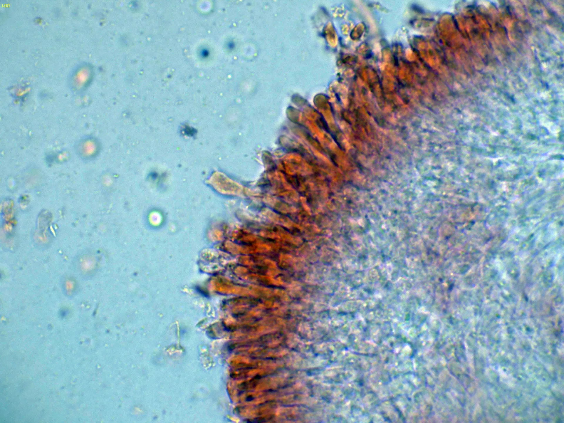 Microscopía de Rhizocybe vermicularis - 10 - Basidios-001